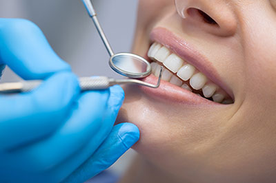 Beneficios de la prevención dental