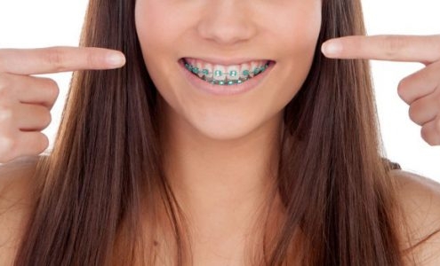 Consejos para el dolor de brackets