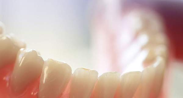 Las dentaduras postizas o los dientes postizos realizados sobre la