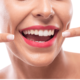 Blanqueamiento dental