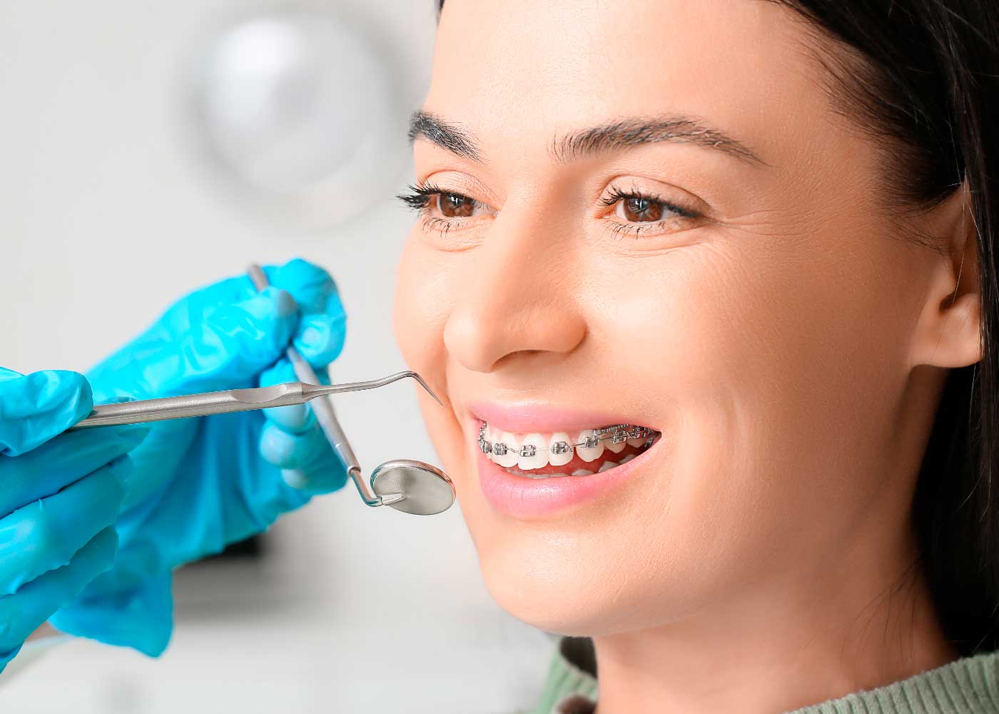 Revisión de ortodoncia con brackets en una paciente adulta
