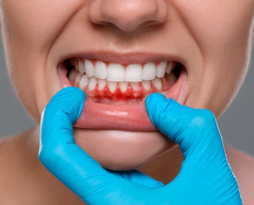 Exploración de las encías durante una revisión dental