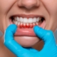 Exploración de las encías durante una revisión dental