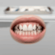 Caries en adolescentes