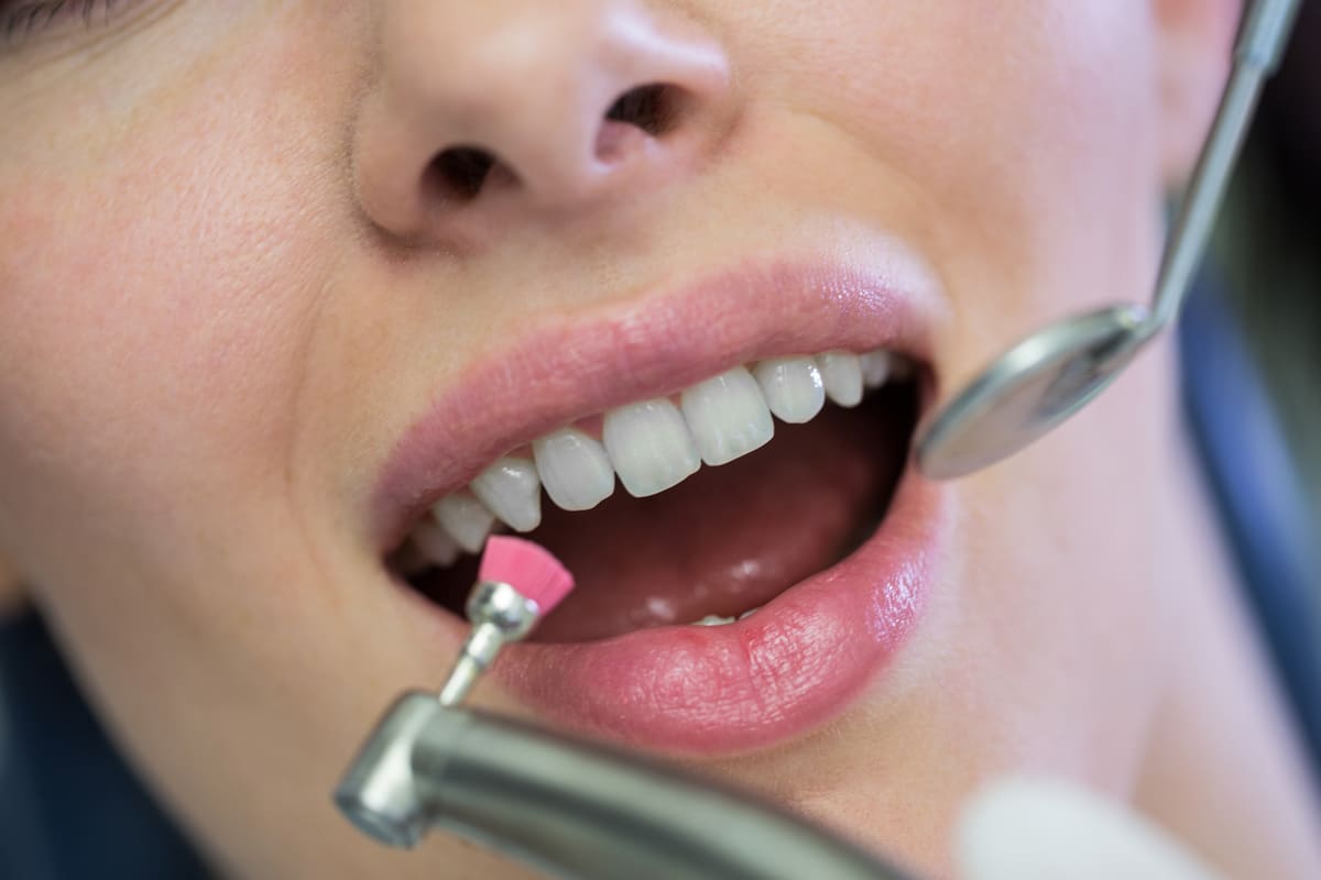 Exploración dental con espejo e instrumental