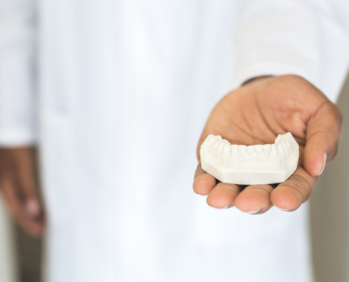 Molde dental de prótesis - dentadura postiza removible vs implante fijo