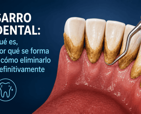 Sarro dental: qué es, por qué se forma y cómo eliminarlo definitivamente