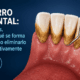 Sarro dental: qué es, por qué se forma y cómo eliminarlo definitivamente