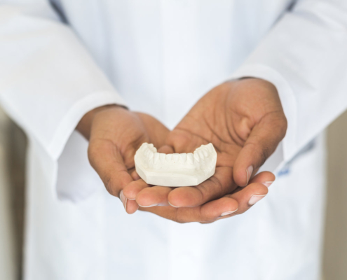 Molde de dientes y corona dental - tipos de prótesis fijas