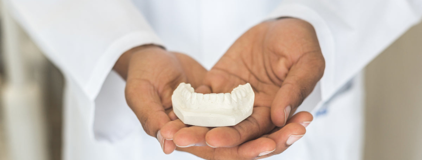 Molde de dientes y corona dental - tipos de prótesis fijas